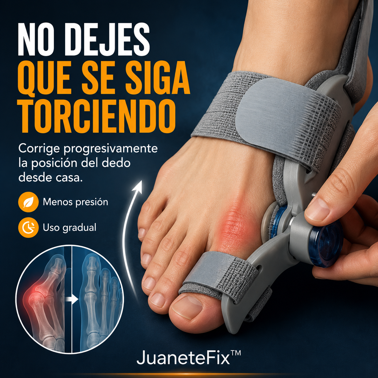 JuaneteFix™ | Corrector de Dedo Torcido Desde Casa
